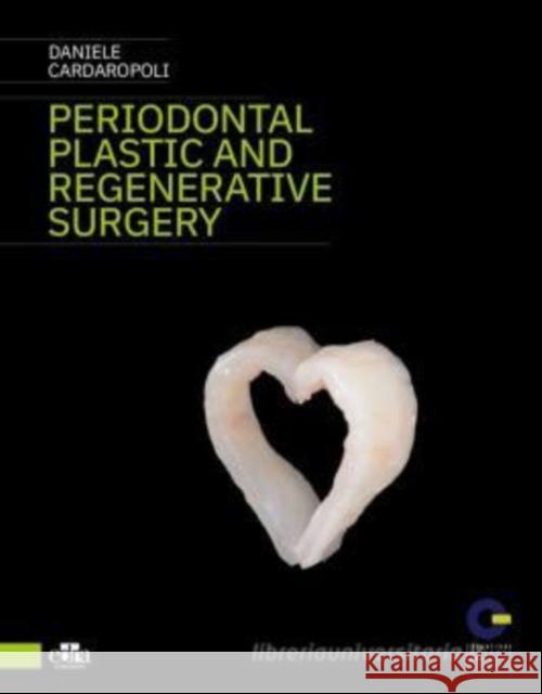 Periodontal Plastic and Regenerative Surgery Daniele  Cardaropoli M. Nevins M. Sanz 9781957260075 Edra Publishing US LLC - książka