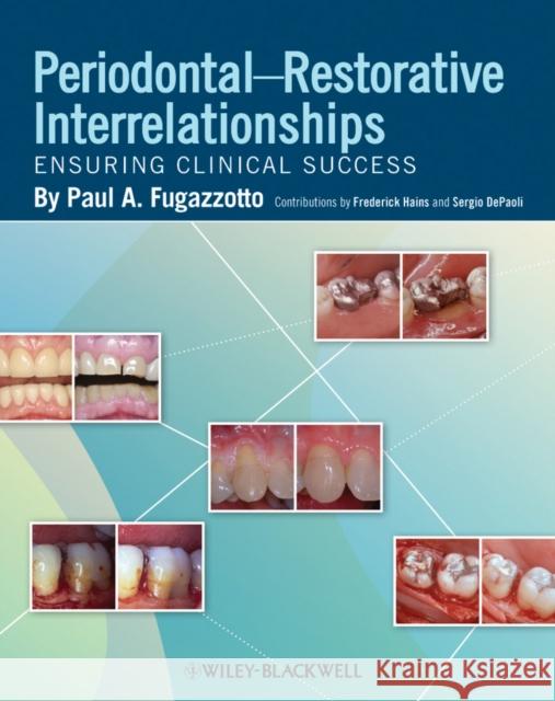 Periodontal-Restorative Interrelationships: Ensuring Clinical Success Fugazzotto, Paul A. 9780813811673  - książka