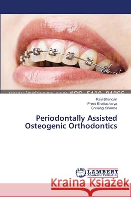 Periodontally Assisted Osteogenic Orthodontics Bhandari Ravi                            Bhattacharya Preeti                      Sharma Shivangi 9783659553974 LAP Lambert Academic Publishing - książka