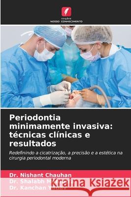 Periodontia minimamente invasiva: técnicas clínicas e resultados Chauhan, Dr. Nishant, Mehrotra, Dr. Shalabh, Yadav, Dr. Kanchan 9786202435673 Edições Nosso Conhecimento - książka