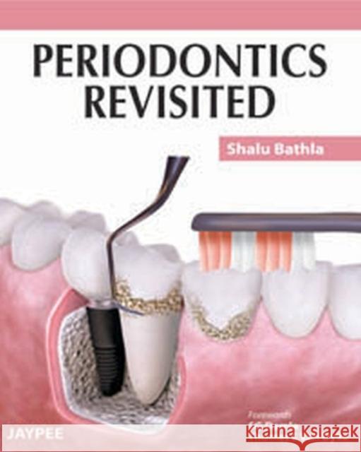 Periodontics Revisited Shalu Bathla 9789350253670 Jp Medical Ltd - książka