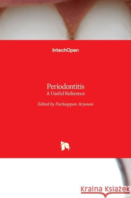 Periodontitis: A Useful Reference Pachiappan Arjunan 9789535136057 Intechopen - książka