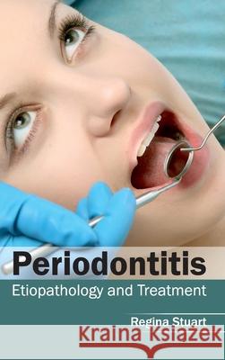 Periodontitis: Etiopathology and Treatment Regina Stuart 9781632413192 Hayle Medical - książka