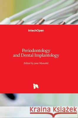 Periodontology and Dental Implantology Jane Manakil 9781789849318 Intechopen - książka