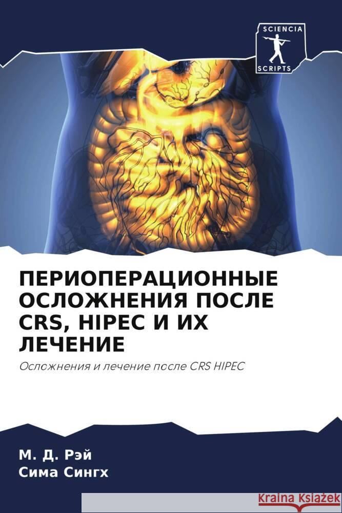 PERIOPERACIONNYE OSLOZhNENIYa POSLE CRS, HIPEC I IH LEChENIE Räj, M. D., Singh, Sima 9786204850795 Sciencia Scripts - książka