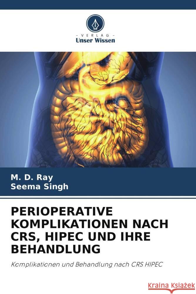 PERIOPERATIVE KOMPLIKATIONEN NACH CRS, HIPEC UND IHRE BEHANDLUNG Ray, M. D., Singh, Seema 9786204850504 Verlag Unser Wissen - książka