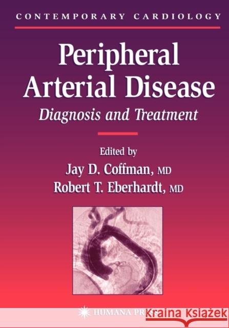 Peripheral Arterial Disease: Diagnosis and Treatment Coffman, Jay D. 9781588290526 Humana Press - książka