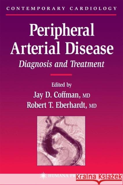 Peripheral Arterial Disease: Diagnosis and Treatment Coffman, Jay D. 9781617373268 Springer - książka