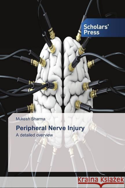 Peripheral Nerve Injury : A detailed overview Sharma, Mukesh 9783639861945 Scholar's Press - książka