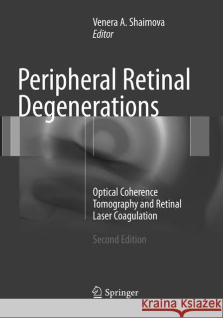 Peripheral Retinal Degenerations: Optical Coherence Tomography and Retinal Laser Coagulation Shaimova, Venera A. 9783319840628 Springer - książka