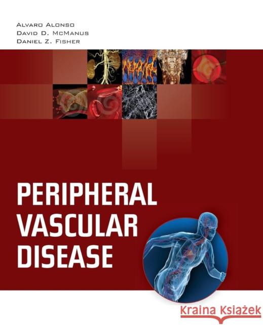 Peripheral Vascular Disease Fisher 9780763755386 JONES AND BARTLETT PUBLISHERS, INC - książka