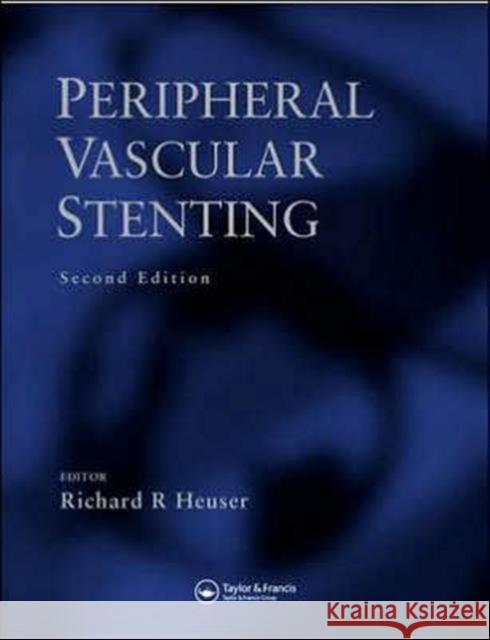 Peripheral Vascular Stenting, Second Edition Raymond Bonnett Heuser R. Heuser Richard R. Heuser 9781841843469 Taylor & Francis Group - książka