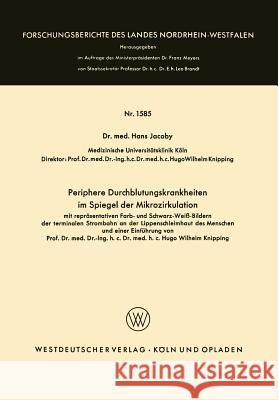 Periphere Durchblutungskrankheiten Im Spiegel Der Mikrozirkulation: Mit Repräsentativen Farb- Und Schwarzweiß-Bildern Der Terminalen Strombahn an Der Jakoby, Hans 9783663066361 Vs Verlag Fur Sozialwissenschaften - książka