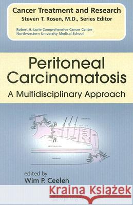 Peritoneal Carcinomatosis: A Multidisciplinary Approach Wim P. Ceelen 9780387489919 Springer - książka