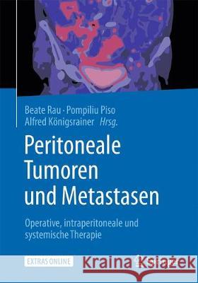 Peritoneale Tumoren Und Metastasen: Operative, Intraperitoneale Und Systemische Therapie Rau, Beate 9783662544990 Springer - książka