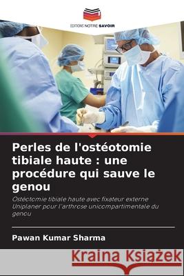 Perles de l'ostéotomie tibiale haute : une procédure qui sauve le genou Sharma, Pawan Kumar 9786208810672 Editions Notre Savoir - książka