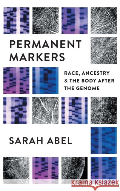 Permanent Markers: Race, Ancestry, and the Body After the Genome Sarah Abel 9781469665146 University of North Carolina Press - książka