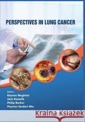 Perspectives in Lung Cancer Jack Kastelik Philip Barber Peyman Sardar 9789811459559 Bentham Science Publishers - książka