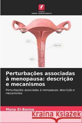 Perturbações associadas à menopausa: descrição e mecanismos El-Banna, Mona 9786208802431 Edições Nosso Conhecimento - książka