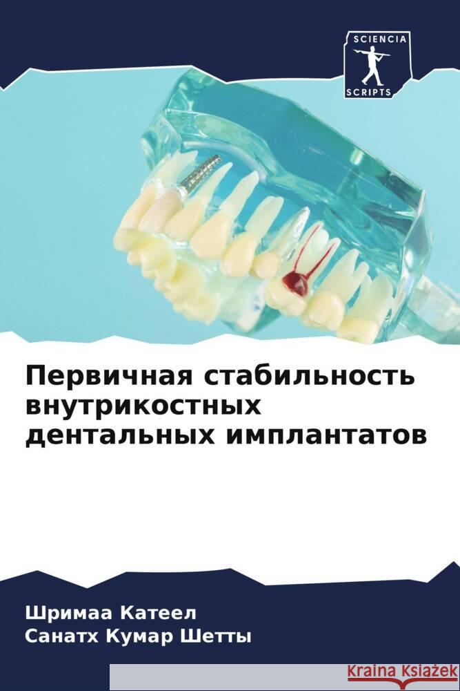 Perwichnaq stabil'nost' wnutrikostnyh dental'nyh implantatow Kateel, Shrimaa, Shetty, Sanath Kumar 9786204696393 Sciencia Scripts - książka