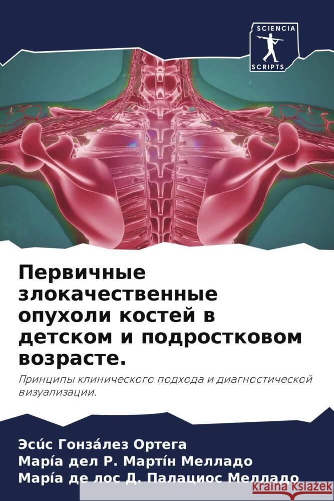 Perwichnye zlokachestwennye opuholi kostej w detskom i podrostkowom wozraste. González Ortega, Jesús, Martín Mellado, María del R., Palacios Mellado, María de los D. 9786205044018 Sciencia Scripts - książka