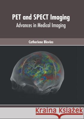 Pet and Spect Imaging: Advances in Medical Imaging Catheriene Blevins 9781639270781 American Medical Publishers - książka