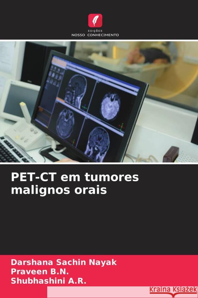 PET-CT em tumores malignos orais Nayak, Darshana Sachin, B.N., Praveen, A.R., Shubhashini 9786206402688 Edições Nosso Conhecimento - książka