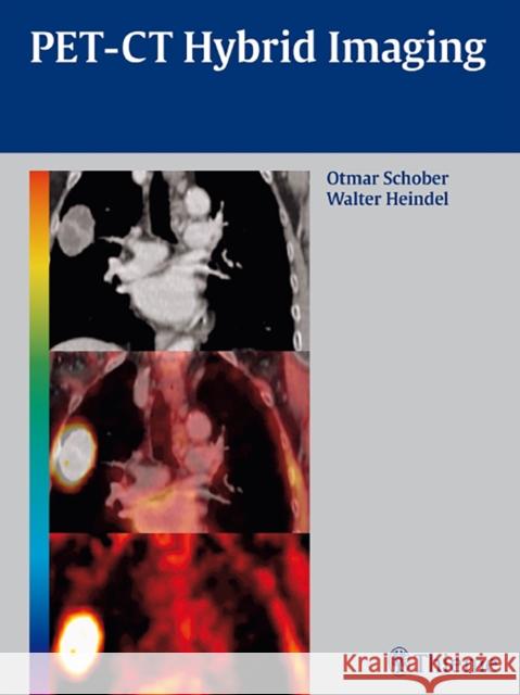 Pet-CT Hybrid Imaging Schober, Otmar 9783131488619 Thieme Medical Publishers - książka