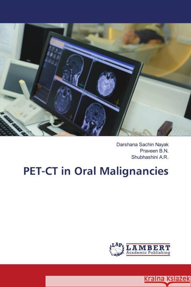 PET-CT in Oral Malignancies Nayak, Darshana Sachin, B.N., Praveen, A.R., Shubhashini 9786206754947 LAP Lambert Academic Publishing - książka