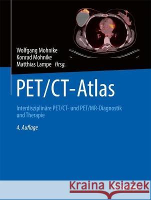 Pet/Ct-Atlas: Interdisziplin?re Pet/Ct- Und Pet/Mr-Diagnostik Und Therapie Wolfgang Mohnike Konrad Mohnike Matthias Lampe 9783662671917 Springer - książka