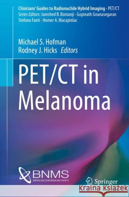 Pet/CT in Melanoma Hofman, Michael S. 9783319547404 Springer - książka
