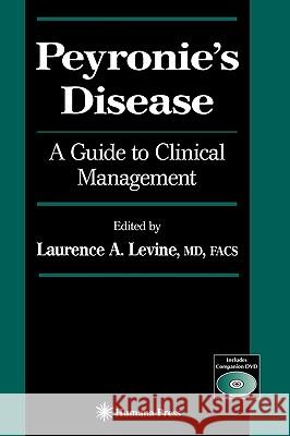 Peyronie's Disease: A Guide to Clinical Management Levine, Laurence A. 9781588296146 Humana Press - książka