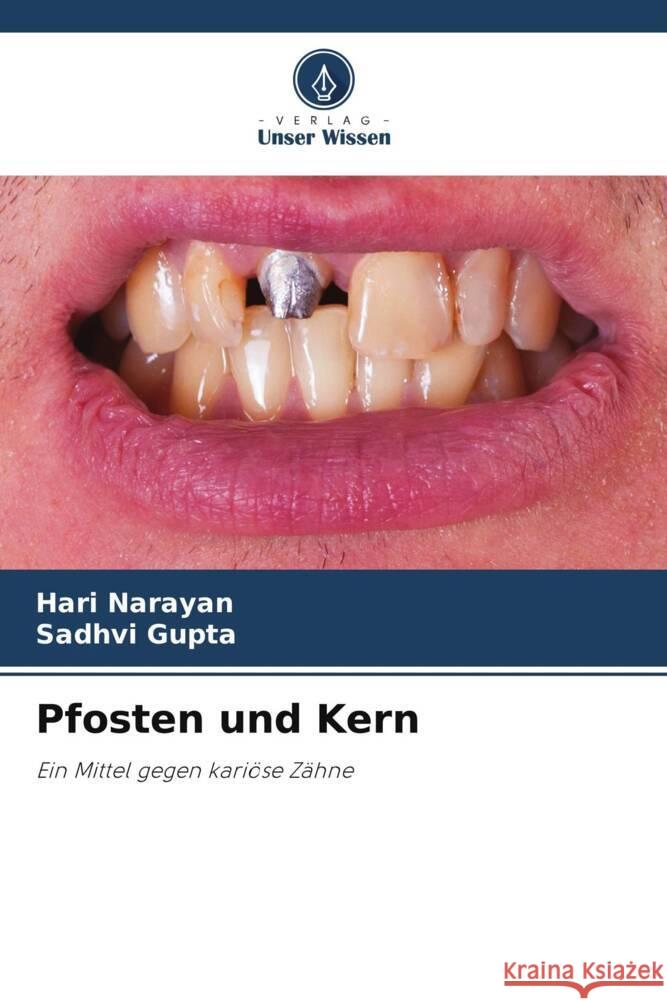 Pfosten und Kern Narayan, Hari, Gupta, Sadhvi 9786206423485 Verlag Unser Wissen - książka