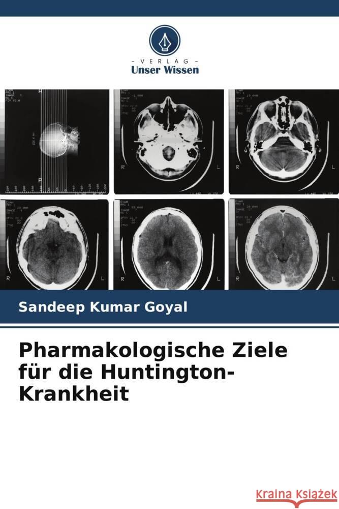 Pharmakologische Ziele f?r die Huntington-Krankheit Sandeep Kumar Goyal 9786206897637 Verlag Unser Wissen - książka