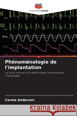 Phénoménologie de l'implantation Anderson, Carole 9786208469573 Editions Notre Savoir - książka