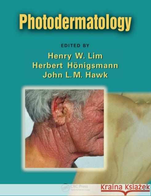 Photodermatology  9780367453190 Taylor and Francis - książka