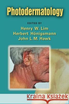 Photodermatology Henry W. Lim Herbert Honigsmann John L. M. Hawk 9780849374968 Informa Healthcare - książka