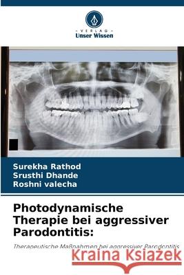 Photodynamische Therapie bei aggressiver Parodontitis: Rathod, Surekha, Dhande, Srusthi, valecha, Roshni 9786209319747 Verlag Unser Wissen - książka
