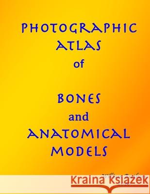 Photographic Atlas of Bones and Anatomical Models MR William Brothers 9781539570448 Createspace Independent Publishing Platform - książka