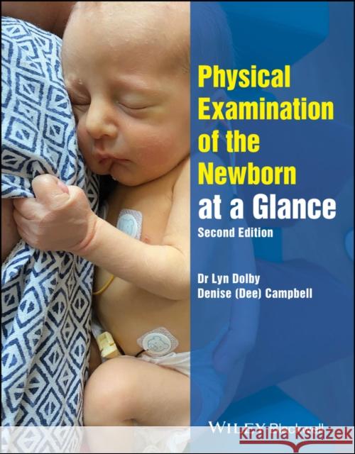 Physical Examination of the Newborn at a Glance Denise (Hertfordshire University, UK) Campbell 9781394277032 John Wiley & Sons Inc - książka