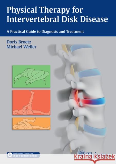 Physical Therapy for Intervertebral Disk Disease: A Practical Guide to Diagnosis and Treatment Brötz, Doris 9783131997616 Tps - książka