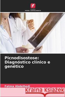 Picnodisostose: Diagnóstico clínico e genético Abdelhedi, Fatma 9786208660505 Edições Nosso Conhecimento - książka