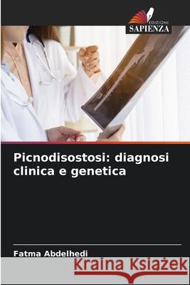 Picnodisostosi: diagnosi clinica e genetica Abdelhedi, Fatma 9786208660420 Edizioni Sapienza - książka