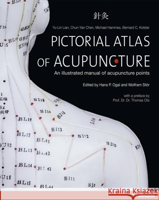 Pictorial Atlas of Acupuncture ,Chen,,Hammes,,Kolster Lian 9783848002368 Ullmann Publishing - książka