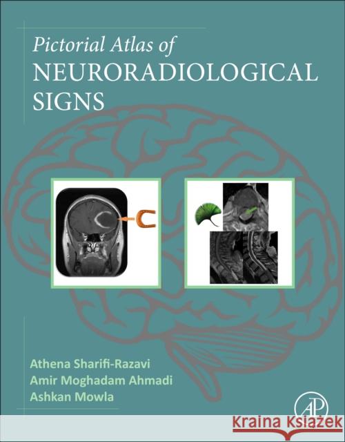 Pictorial Atlas of Neuroradiological Signs Athena Sharifi-Razavi Amir Moghadam Ahmadi Ashkan Mowla 9780443235283 Academic Press - książka