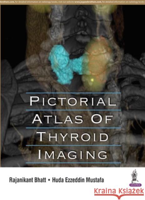 Pictorial Atlas of Thyroid Imaging Rajanikant Bhatt 9789352501281 Jaypee Brothers, Medical Publishers Pvt. Ltd. - książka