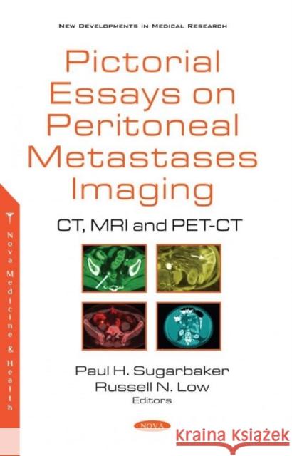 Pictorial Essays on Peritoneal Metastases Imaging: CT, MRI and PET-CT Paul H. Sugarbaker   9781536180145 Nova Science Publishers Inc - książka