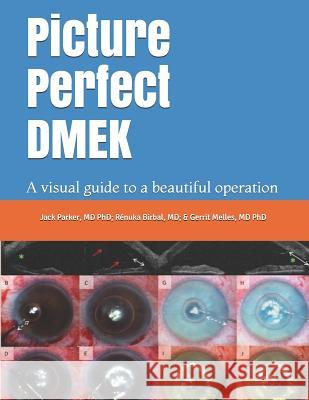 Picture Perfect Dmek: A Visual Guide to a Beautiful Operation R. Birbal Gerrit Melles Jack Parker 9781717773791 Independently Published - książka