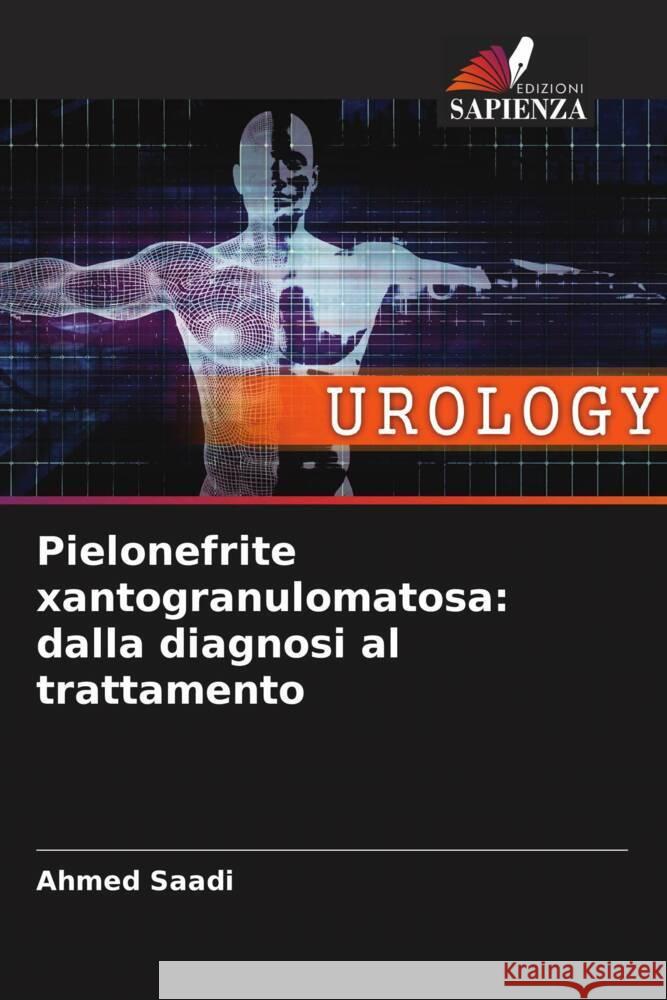 Pielonefrite xantogranulomatosa: dalla diagnosi al trattamento Saadi, Ahmed 9786204777535 Edizioni Sapienza - książka