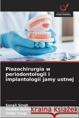 Piezochirurgia w periodontologii i implantologii jamy ustnej Singh, Sonali, Verma, Vartika, Tyagi, Shilpi 9786208485146 Wydawnictwo Nasza Wiedza - książka
